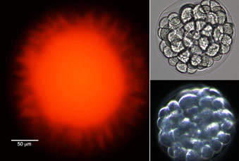 Sea urchin embryo